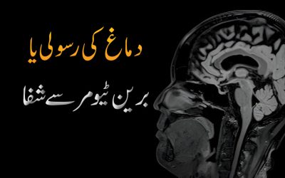 Dimag ki Rasoli or Brain Tumor Se Shifa