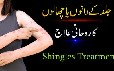 Jild Ke Dano Ka Rohani Ilaj