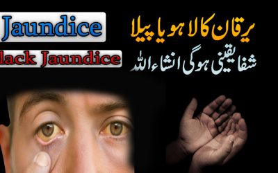 Treatment Of Jaundice And Black Jaundice