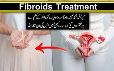 Fibroids Ka Quran Mein Rohani Ilaj