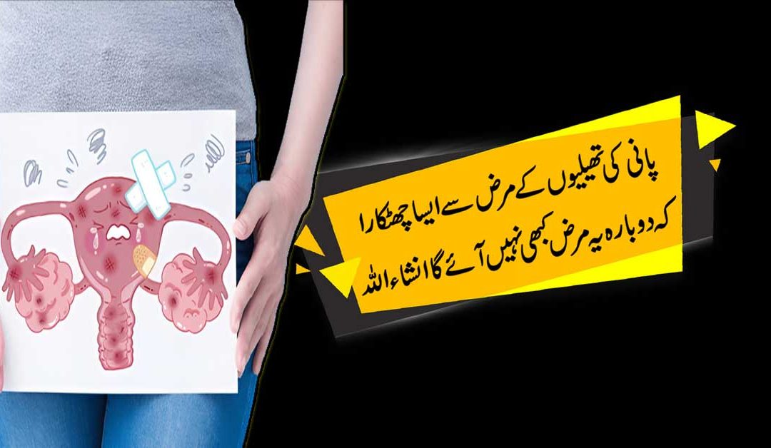 Pani Ki Theliyon (Cysts) Ka Khatam Shuda Rohani Ilaj