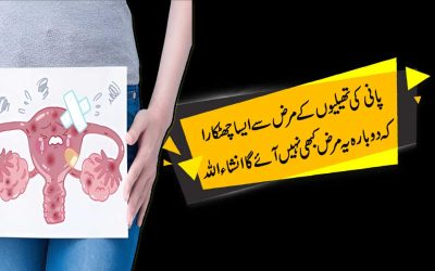 Pani Ki Theliyon Ka Rohani Ilaj