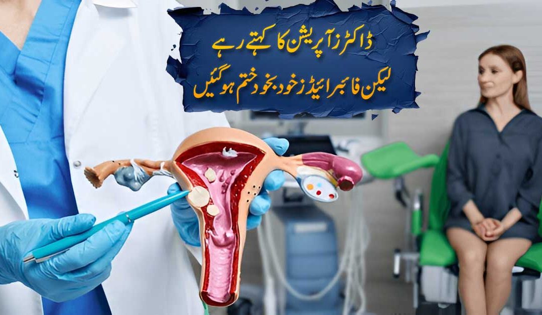 Bina Dawa Aur Operation Ke Fibroids Ka Ilaj