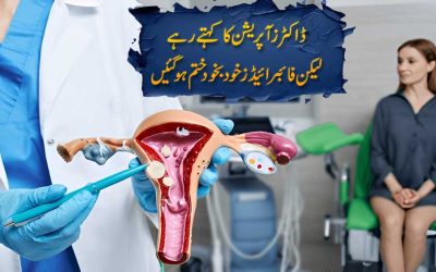 Bina Dawa Aur Operation Ke Fibroids Ka Ilaj