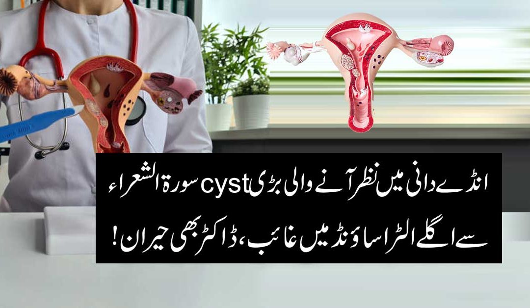 Andedani Mein Pani Ki Tehli Se Shifa Ka Taweez