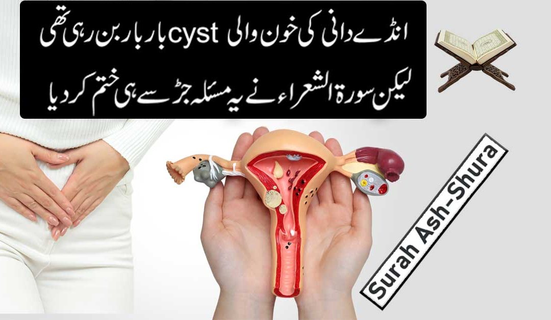 Andedani Ki Khoon Wali Thelion Se Shifa Ka Taweez